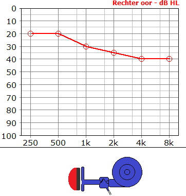 audiogram verklaard